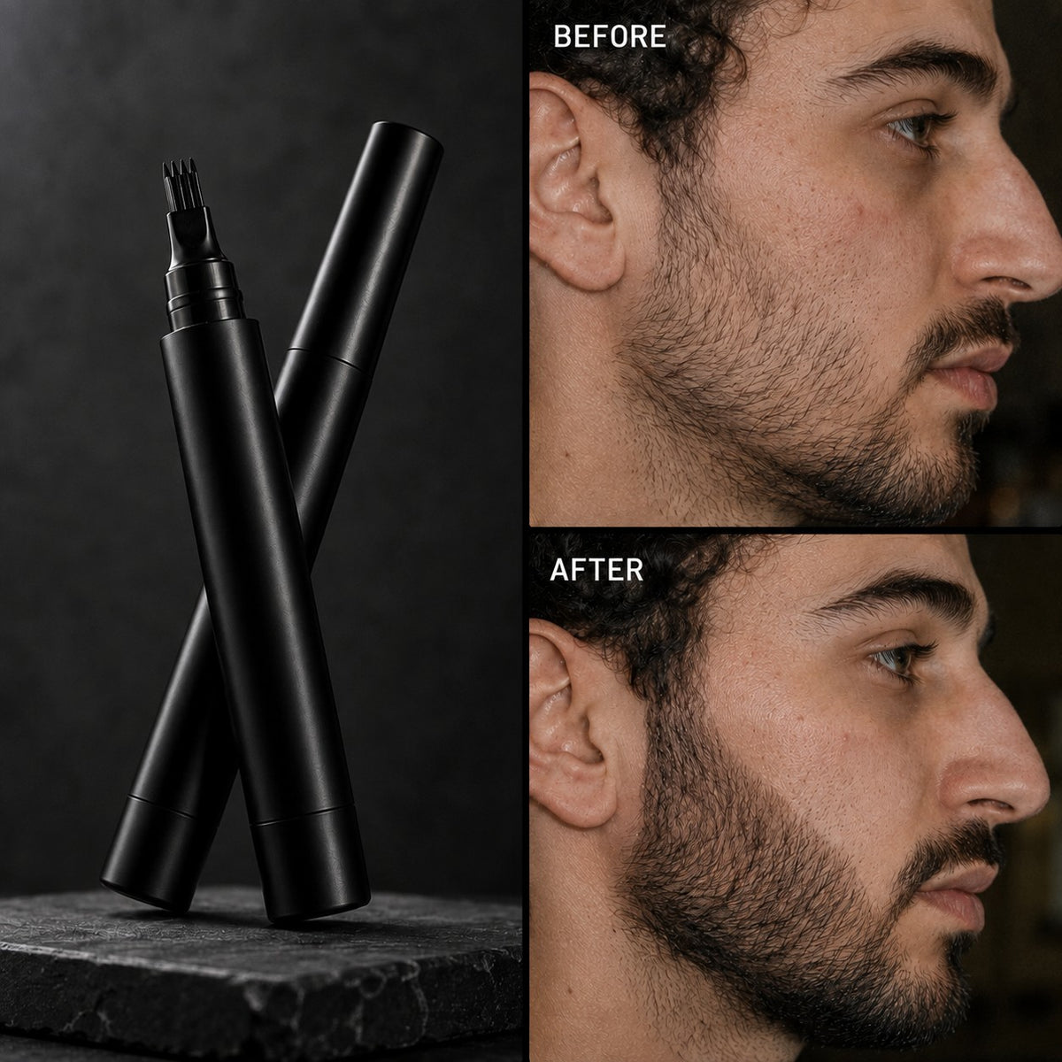 AlphaMale™ Beard Filler Kit